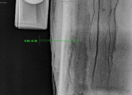 In Service Computed Radiography
