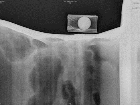 Digital radiography