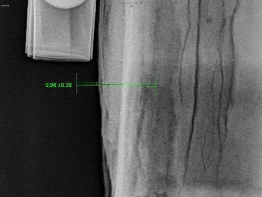 In-Service Computed Radiography
