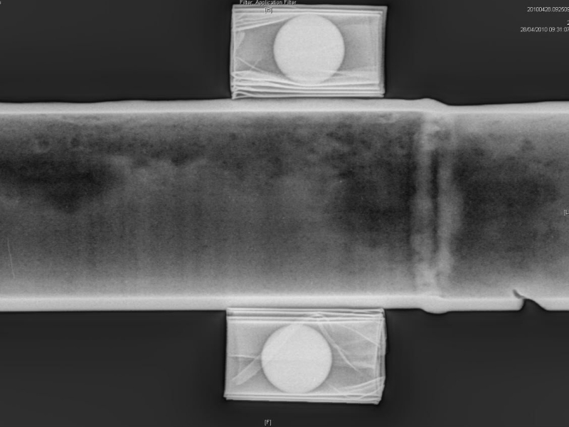 New Digital radiography